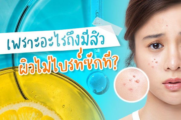 สาเหตุการเกิดสิว